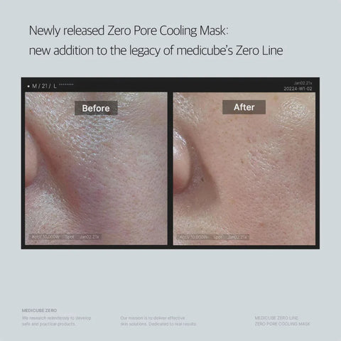 Medicube Zero Pore Cooling Mask (1Pc)