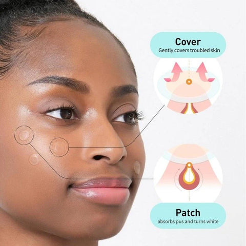 Care Plus Salicylic Acid Trouble Patch (12pcs)